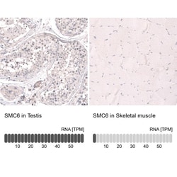 SMC6L1 Antibody, Novus Biologicals 25 &mu;L, Unlabeled:Antibodies, Polyclonal